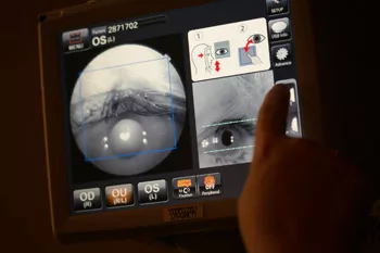 Retinal camera images on a screen